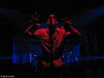 Twisted Nerve