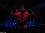 Twisted Nerve